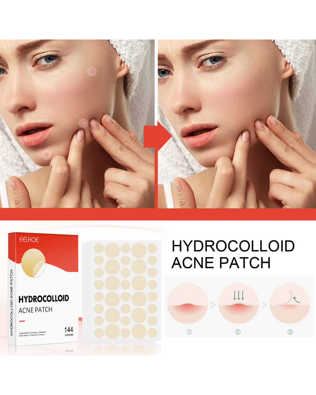 Velviras Hydrocolloid Pimple Patches