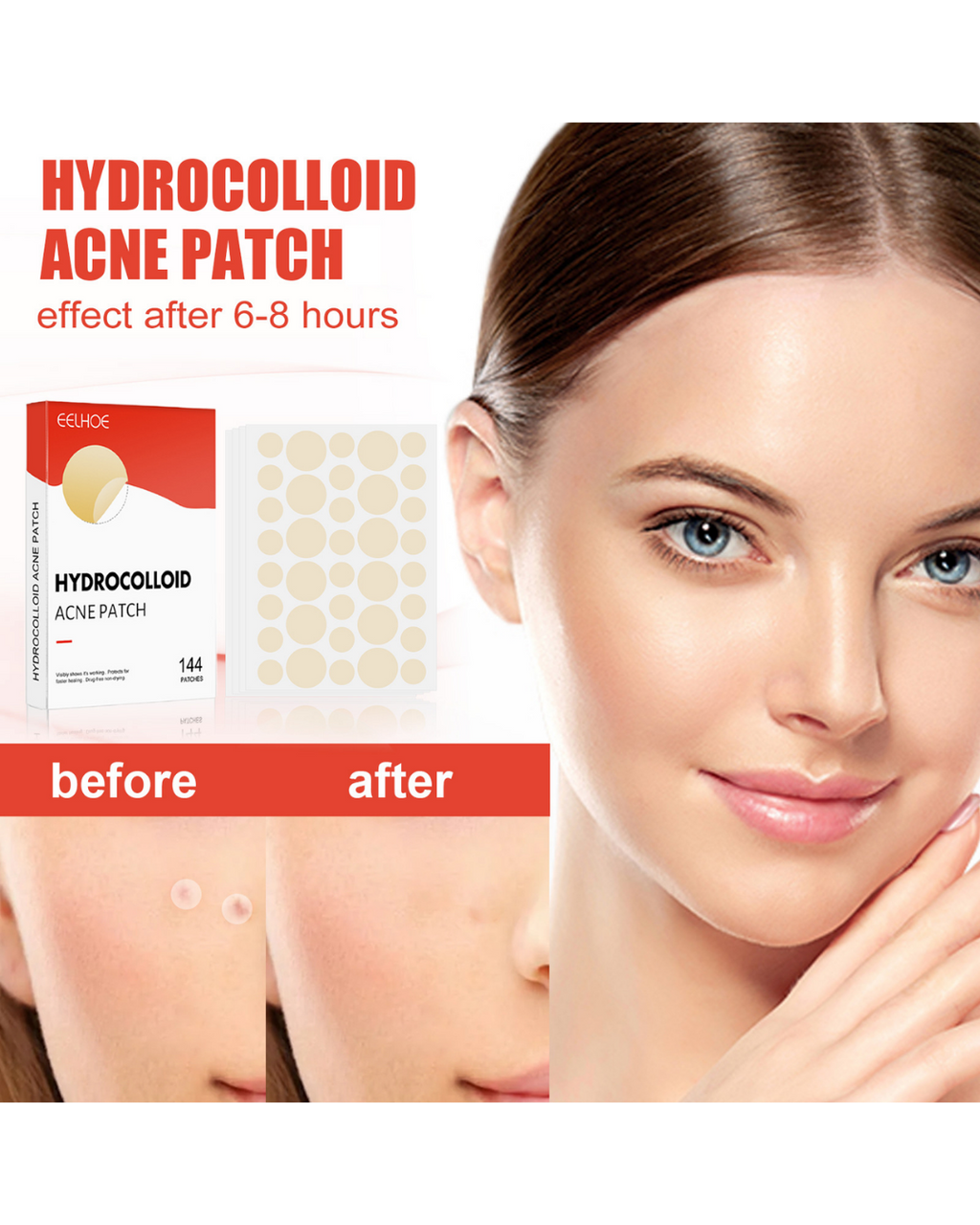 Velviras Hydrocolloid Pimple Patches
