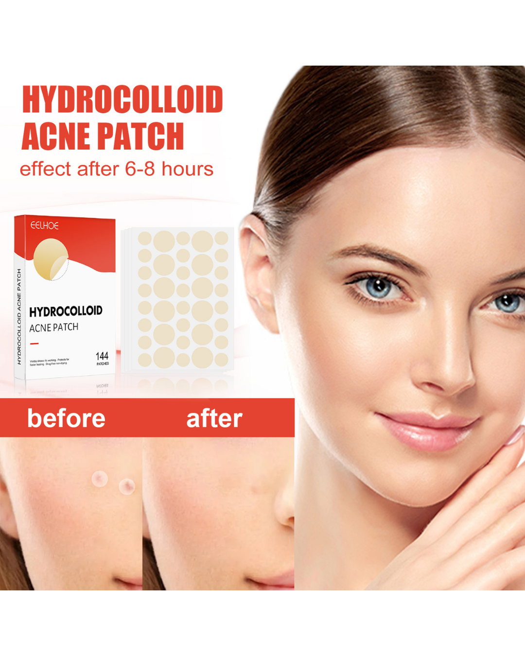 Velviras Hydrocolloid Pimple Patches